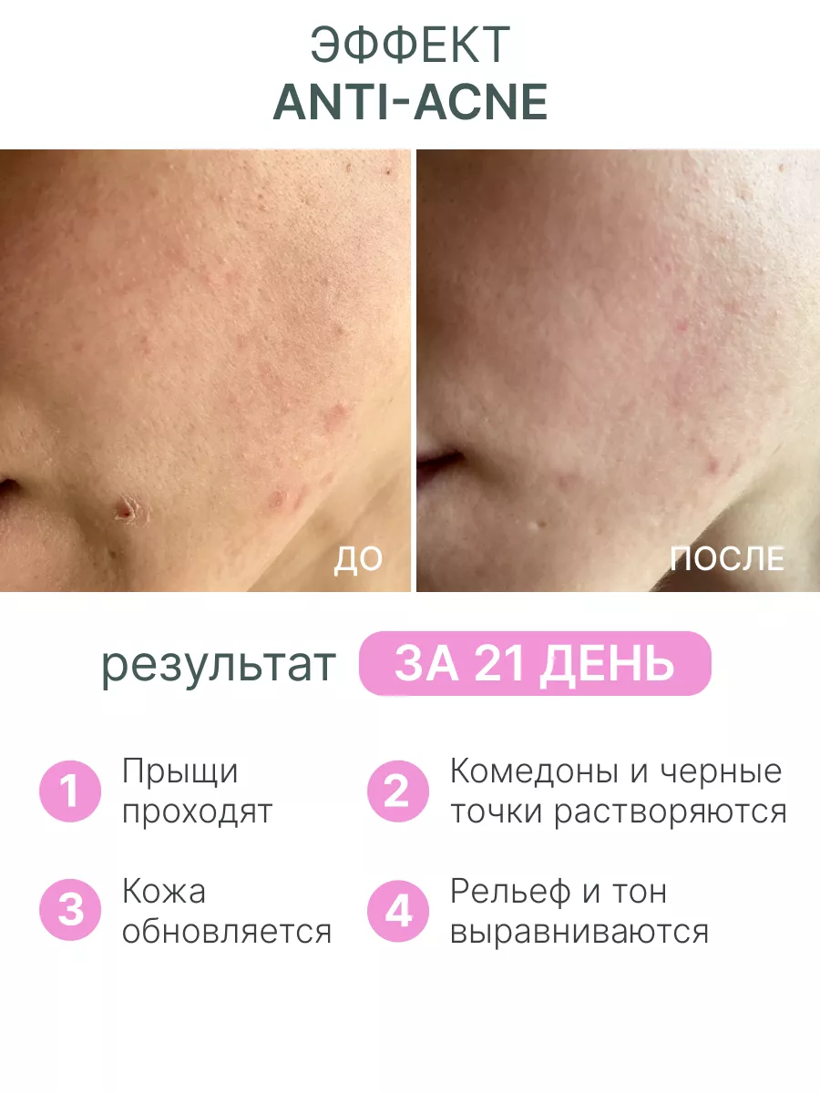 Сыворотка для лица с ретинолом антивозрастная BLOOM COSMETICS 166678923  купить за 403 ₽ в интернет-магазине Wildberries