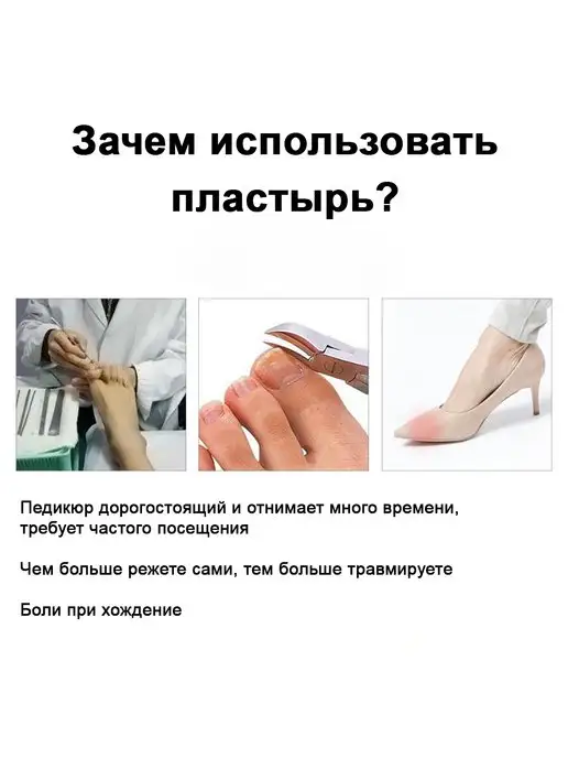 MyLatso Средство тампонада наклейки для коррекции вросших ногтей, белый, фото 5