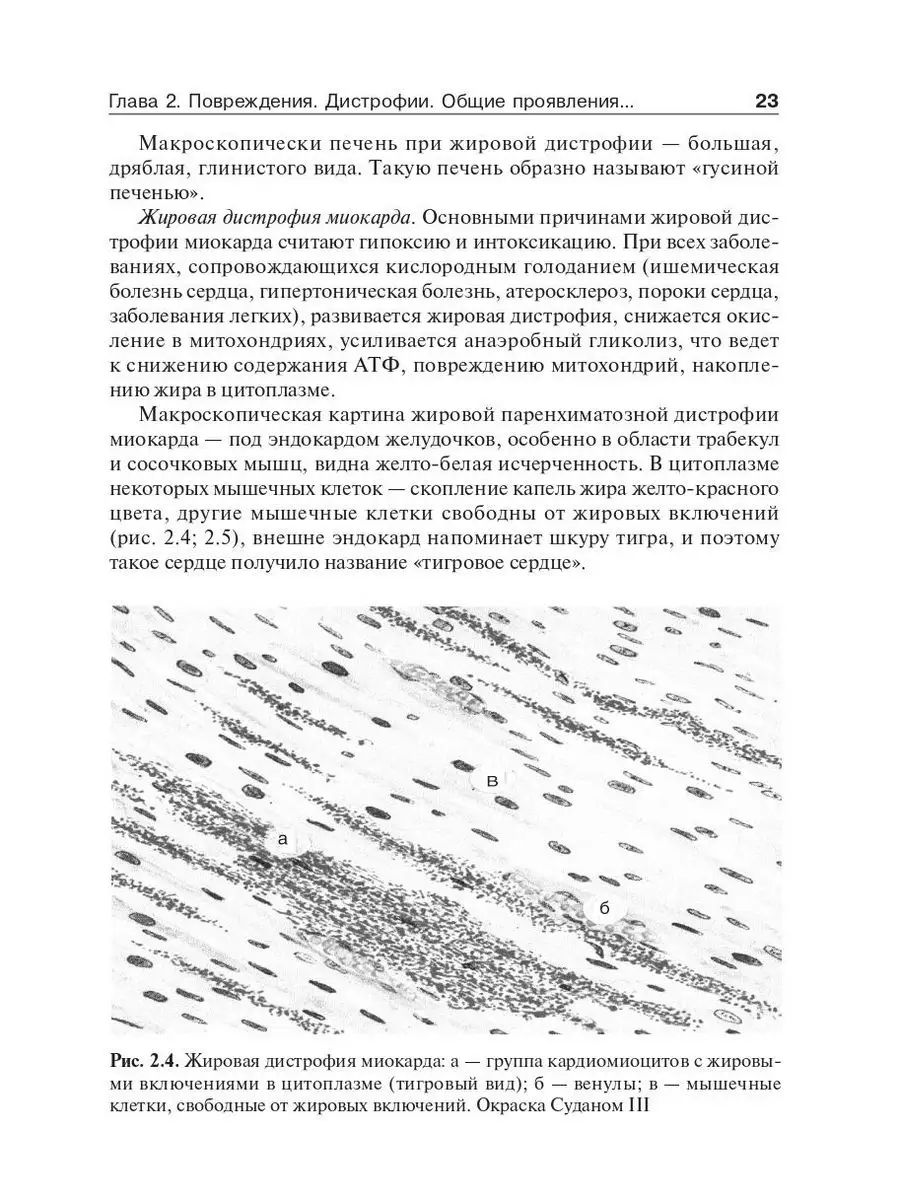 Основы патологии. Учебник ГЭОТАР-Медиа 167090544 купить за 1 585 ₽ в  интернет-магазине Wildberries