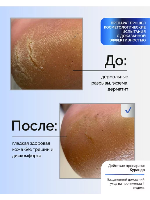KANE PROFESSIONAL Курандо Крем для работы с трещинами, 100 мл, 100 мл, фото 5