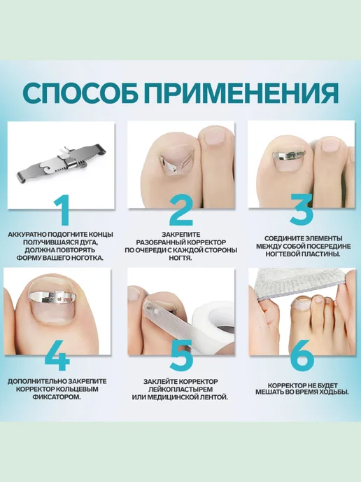 QF Корректор-фиксатор для вросшего ногтя M, серый, фото 4