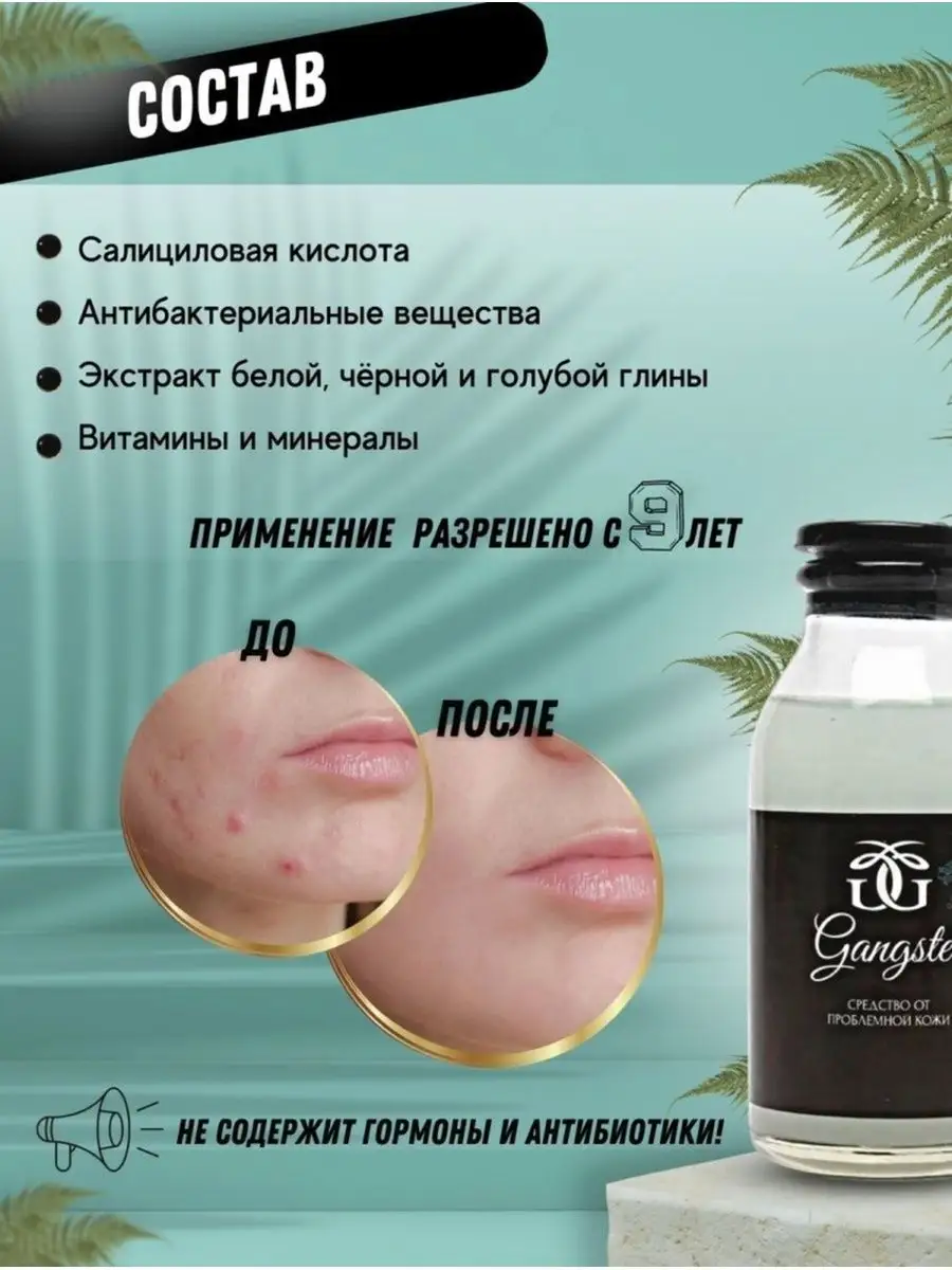 Болтушка от прыщей GANGSTER 168752218 купить за 447 ₽ в интернет-магазине  Wildberries