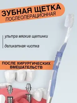 Зубная щетка Postsurgical Ultra Soft Послеооперационная PIERROT 168855714 купить за 303 ₽ в интернет-магазине Wildberries