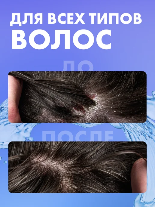 BELITA Шампунь для мужчин против перхоти Bielita for Men 250 мл, 250 мл, фото 2