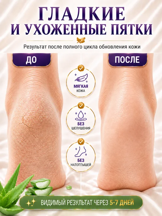 HODAF Пилинг носочки (2 шт) маска отшелушивающая для ног, 2 шт, фото 3
