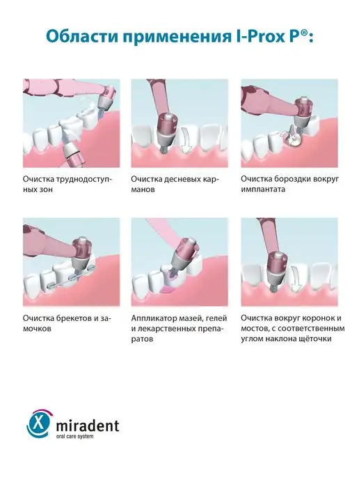 miradent Монопучковая щетка для десновых бороздок i-Prox P розовая, розовый, фото 3