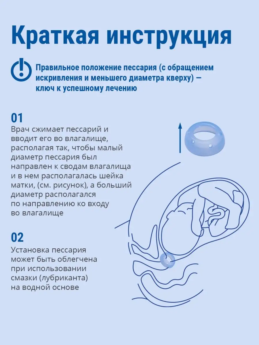 Выпадение матки и влагалища: диагностика и лечение в «СМ-Клиника»