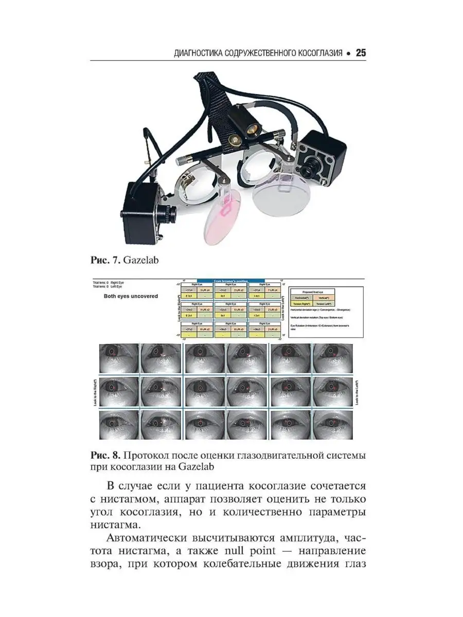 Диагностика и лечение содружественного сходящегося косог... ГЭОТАР-Медиа  169921986 купить за 876 ₽ в интернет-магазине Wildberries