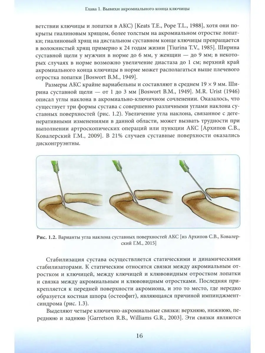 Повреждения ключицы: Учебное пособие МИА 169926660 купить за 3 085 ₽ в  интернет-магазине Wildberries