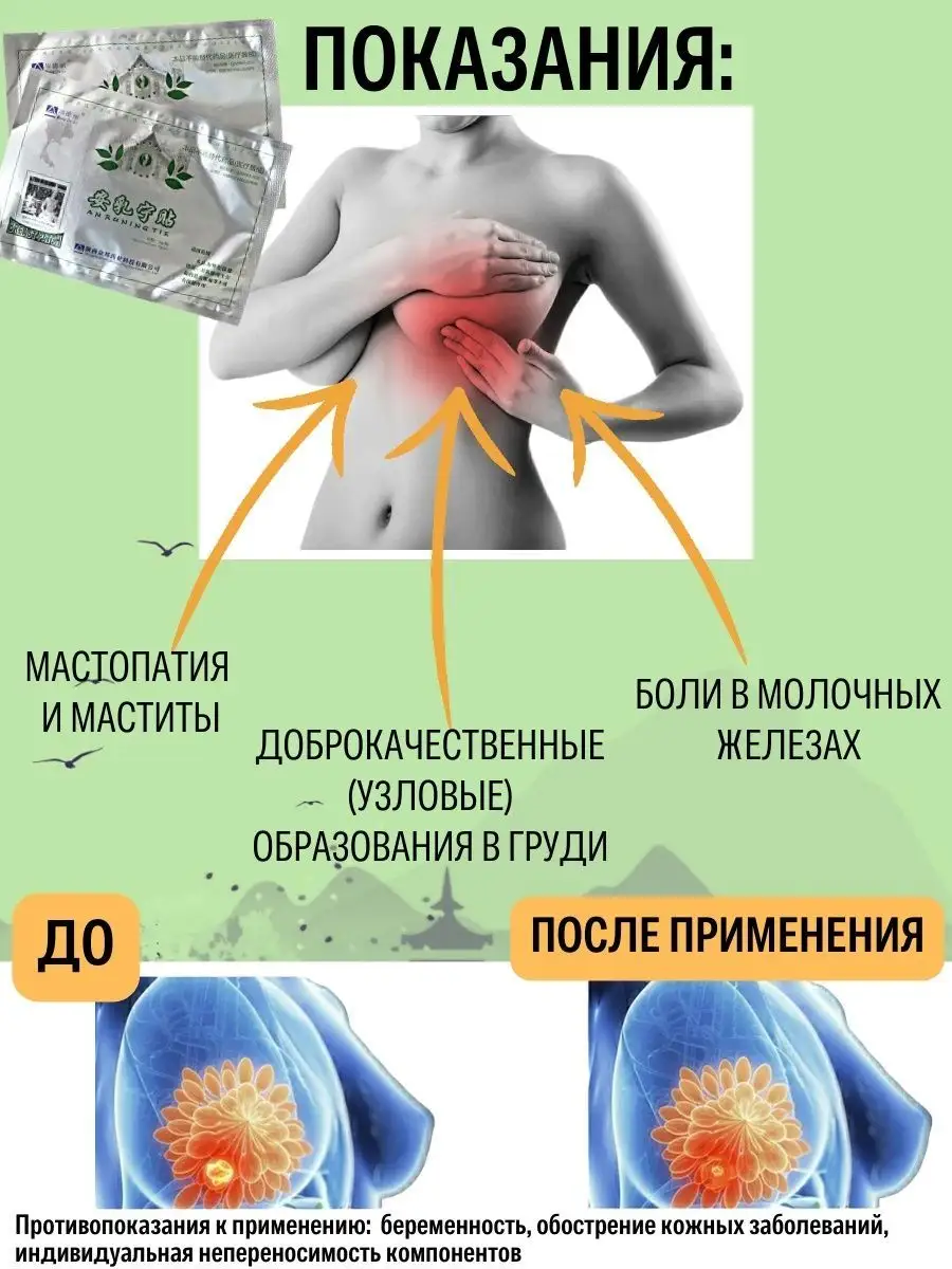 Bandage Пластырь от мастопатии 2шт