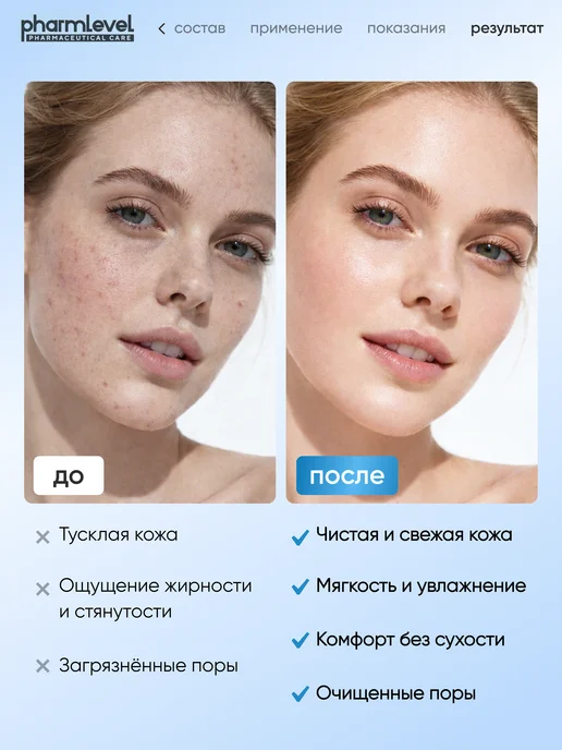 Pharmlevel Мусс пенка для умывания, 150 мл, 150 мл, фото 3