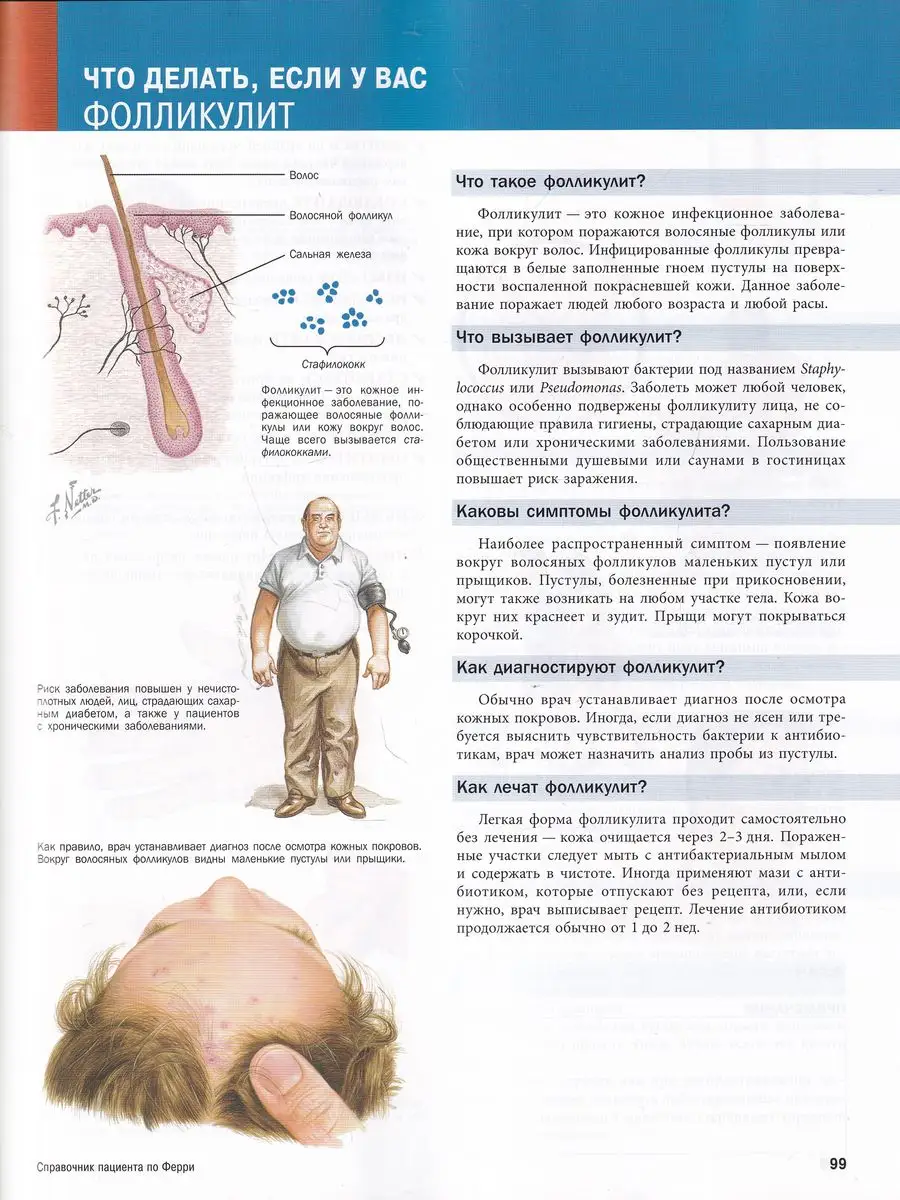 Справочник пациента по Ферри с иллюстрациями Фрэнка Неттера Эко-Вектор  170678001 купить за 7 832 ₽ в интернет-магазине Wildberries