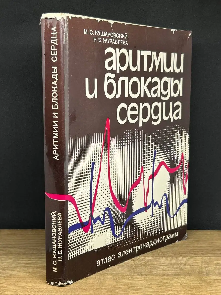 Аритмии и блокады сердца. Атлас электрокардиограмм Медицина 170738989  купить в интернет-магазине Wildberries