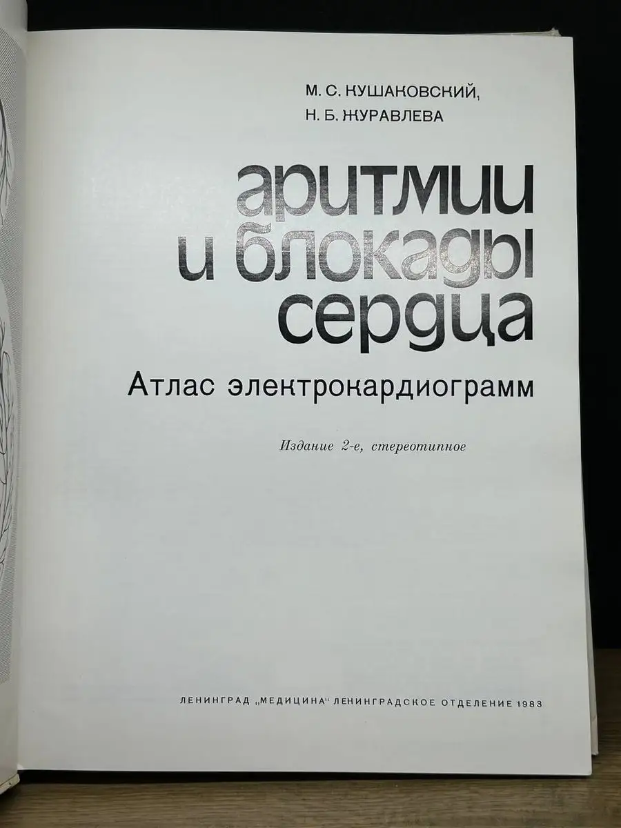 Аритмии и блокады сердца. Атлас электрокардиограмм Медицина 170738989  купить в интернет-магазине Wildberries