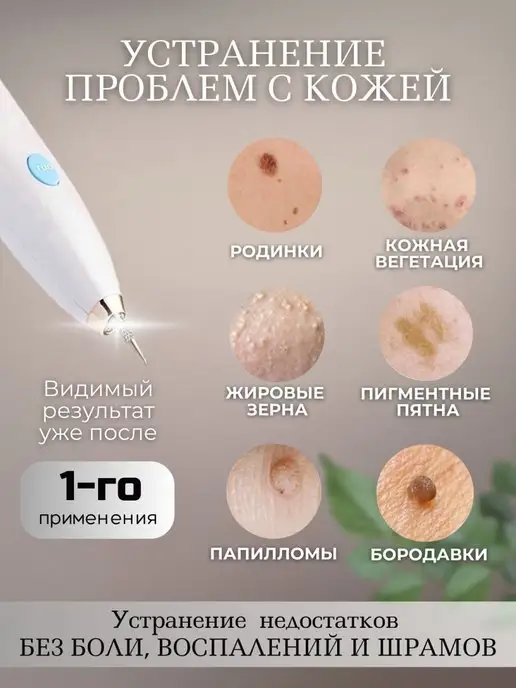 BeautyDream Аппарат коагулятор удаления папиллом бородавок родинок, белый, фото 2