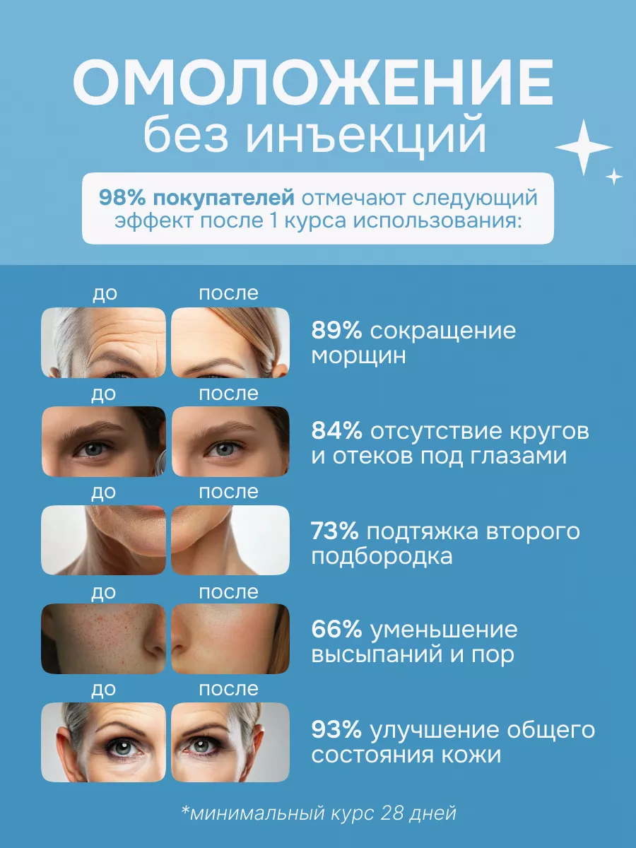 Микротоковый массажер для лица электрический RF лифтинг 