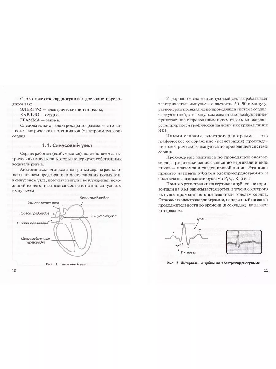 Азбука ЭКГ и Боли в сердце Издательство Феникс 174413941 купить за 94 900  сум в интернет-магазине Wildberries