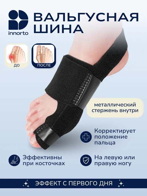 INNORTO Ортез для вальгусного пальца ноги, черный