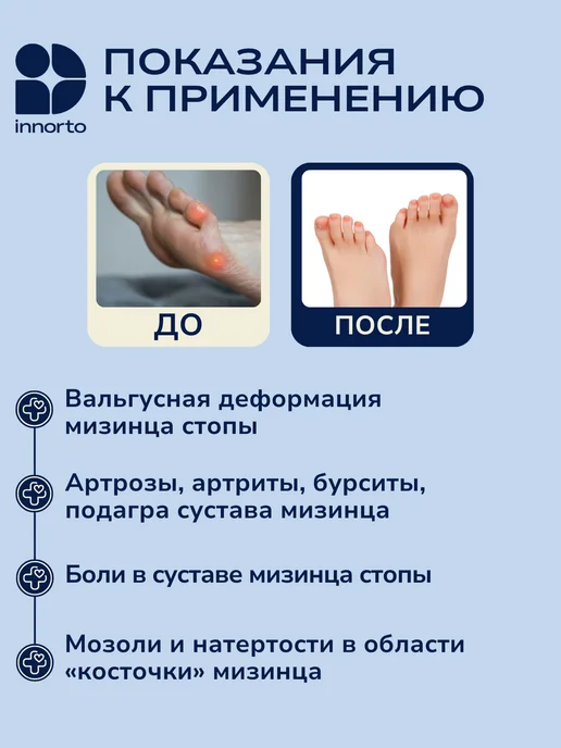 INNORTO Фиксатор для мизинца ноги 52260, белый, фото 2