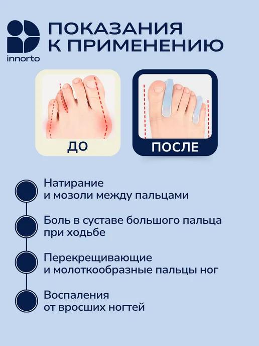 INNORTO Разделители с коррекцией пальцев, белый, фото 2