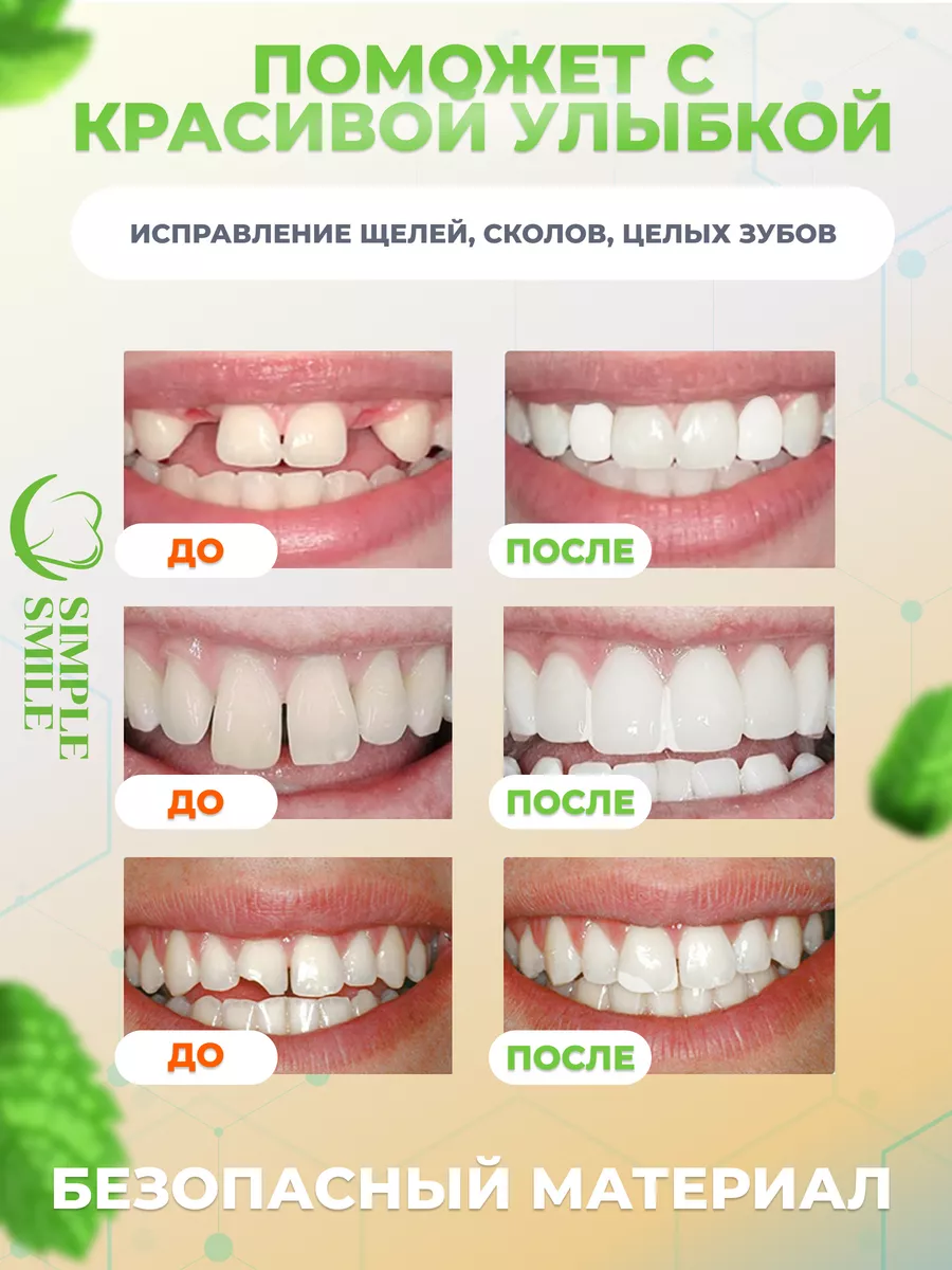 Стоматологический материал временная пломба для зубов Simple Smile  175756026 купить в интернет-магазине Wildberries