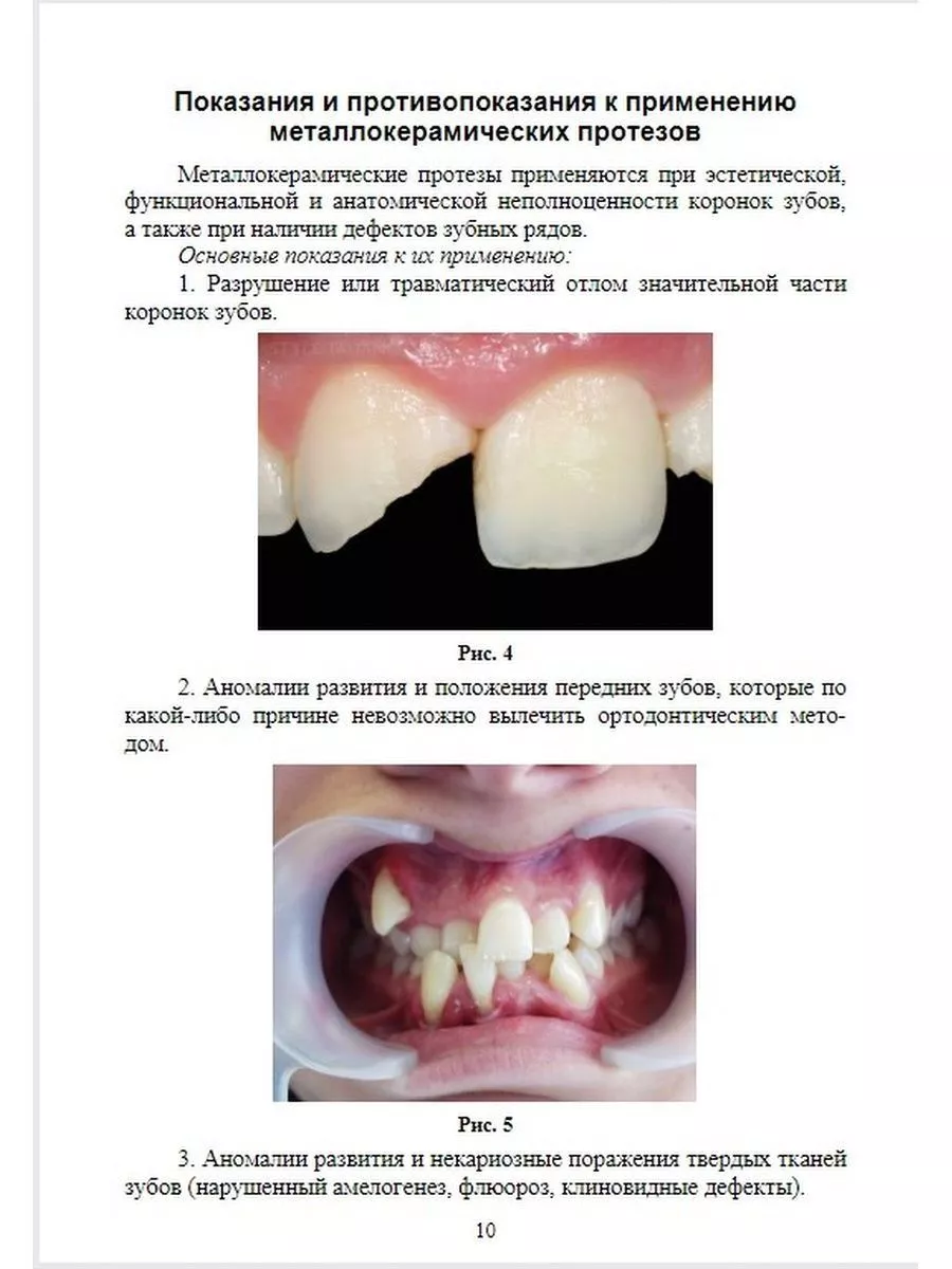 Технология изготовления металлокерамических протезов Каркасы Издательство  Лань 176533243 купить за 551 ₽ в интернет-магазине Wildberries