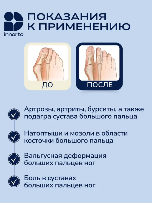 INNORTO Бурсопротектор большого пальца ноги, вариант, фото 2