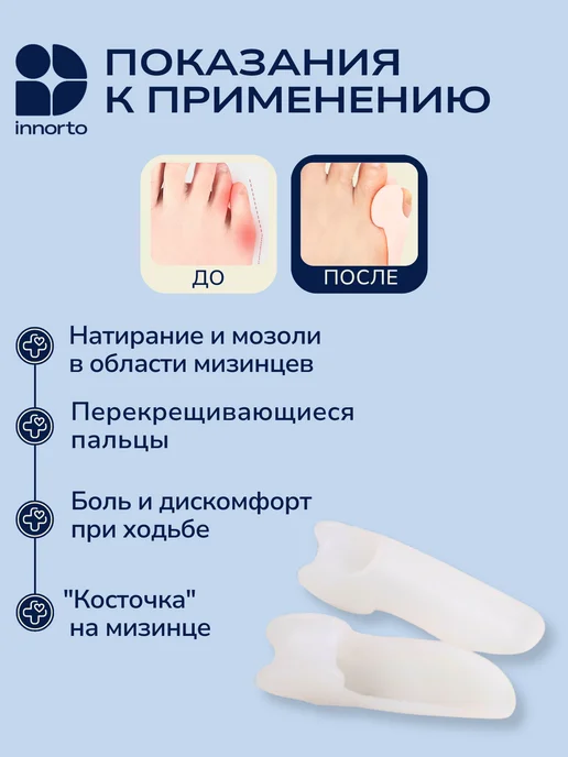 INNORTO Бурсопротектор, разделители мизинца для ног, белый, фото 2