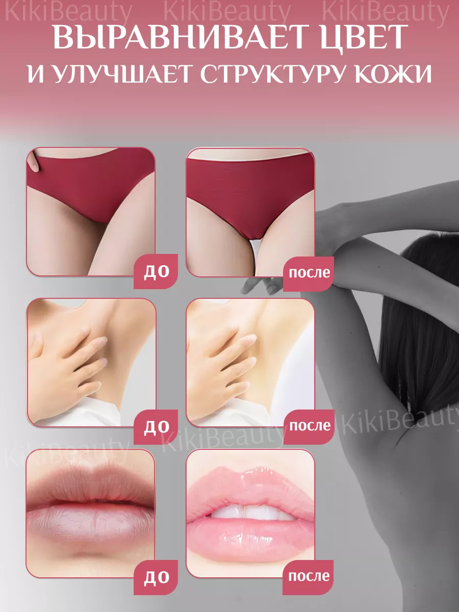 Отбеливающий крем для интимных зон бикини KikiBeauty 177402736 купить в  интернет-магазине Wildberries