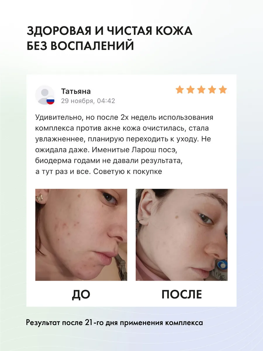 чисто подростковый нудизм 