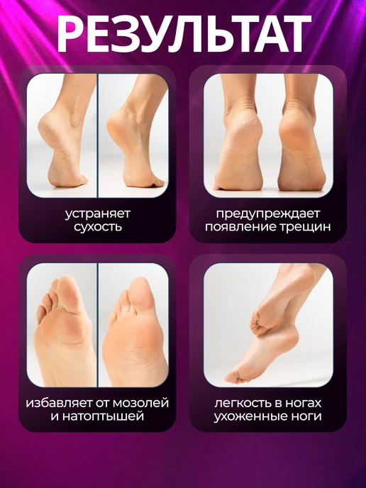 ROMMAC Педикюрный нож скребок для пяток, вариант, фото 5
