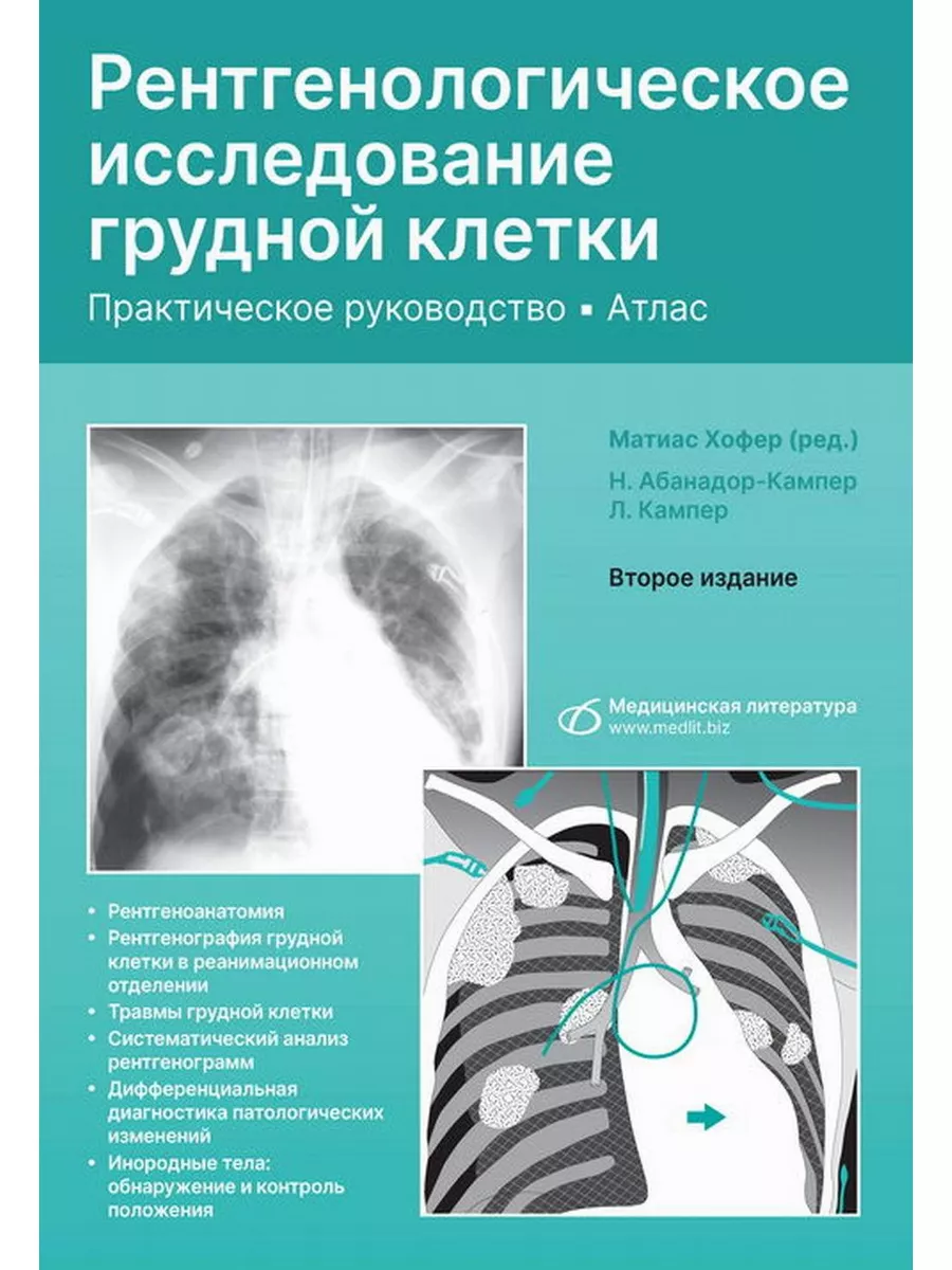 Рентгенологическое исследование грудной клетки. Практиче... Медицинская  литература 179044324 купить за 3 233 ₽ в интернет-магазине Wildberries