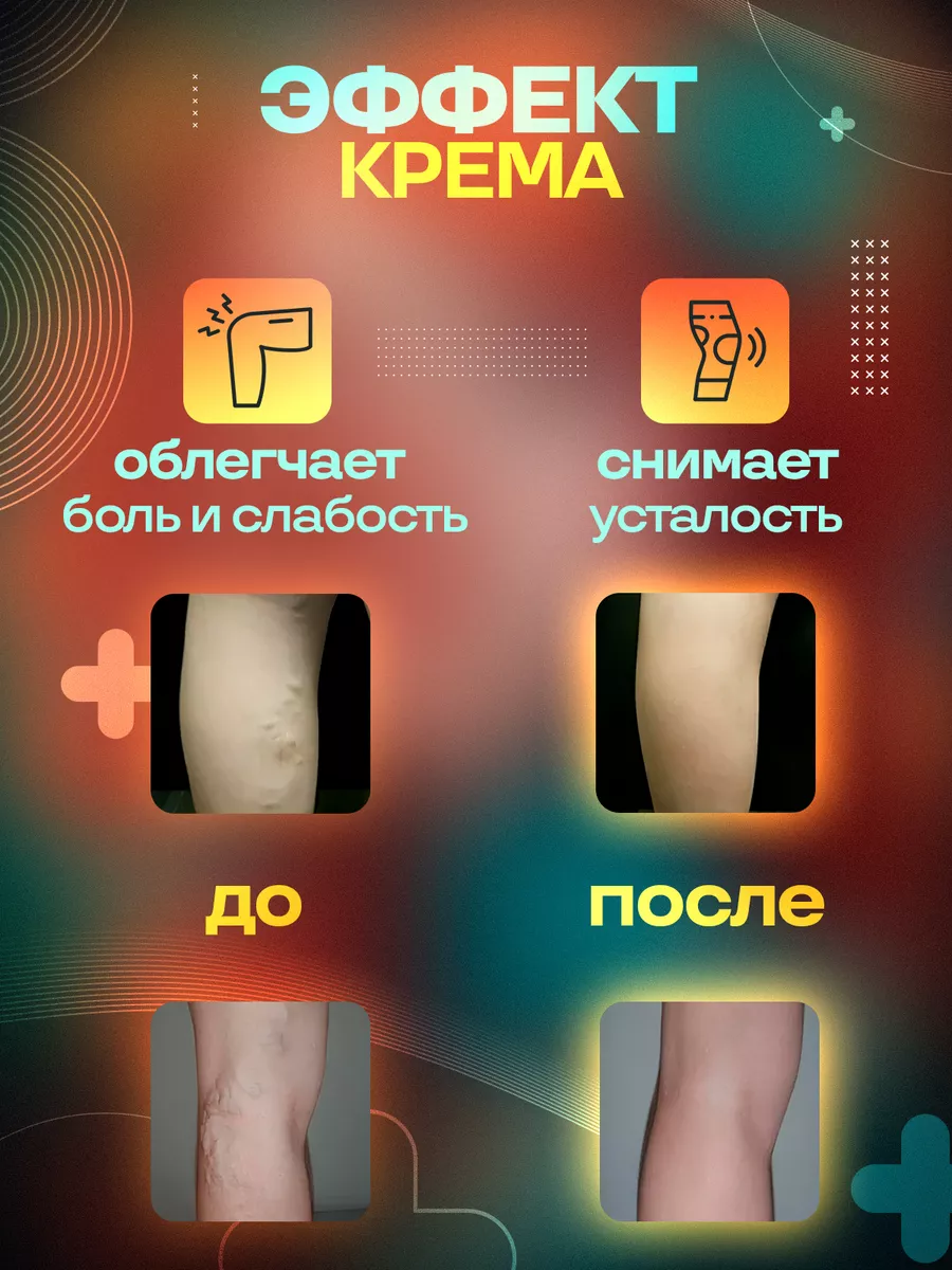 Крем для лечения варикоза ZB Varicose Veins Cream 20г 4HEALTH+ 180564347  купить в интернет-магазине Wildberries