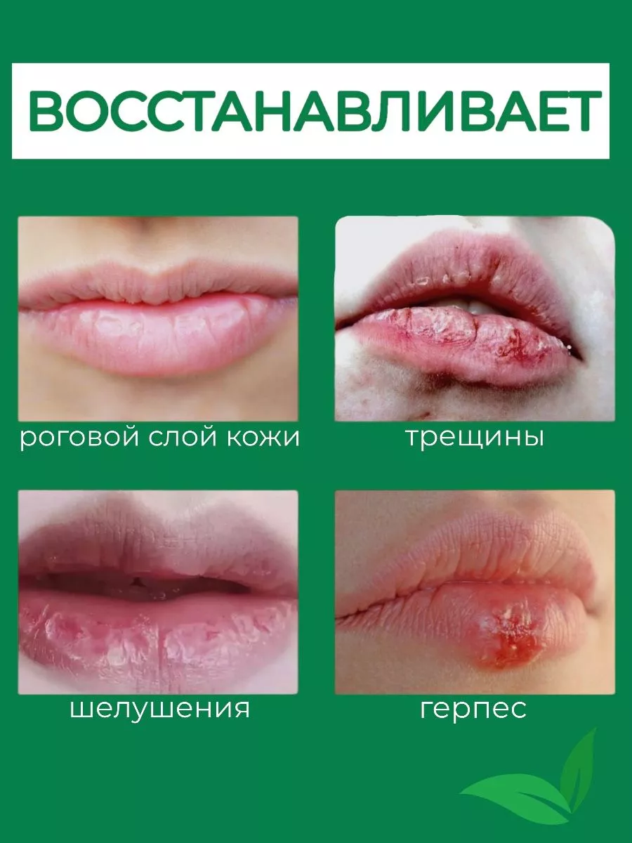 Травяная мазь для губ OCHEAL 181485249 купить за 392 ₽ в интернет-магазине  Wildberries