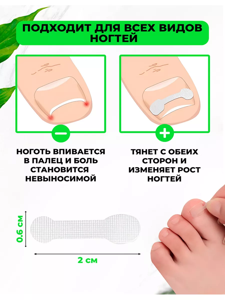 По состоянию ногтей можно понять, какие проблемы со здоровьем у человека