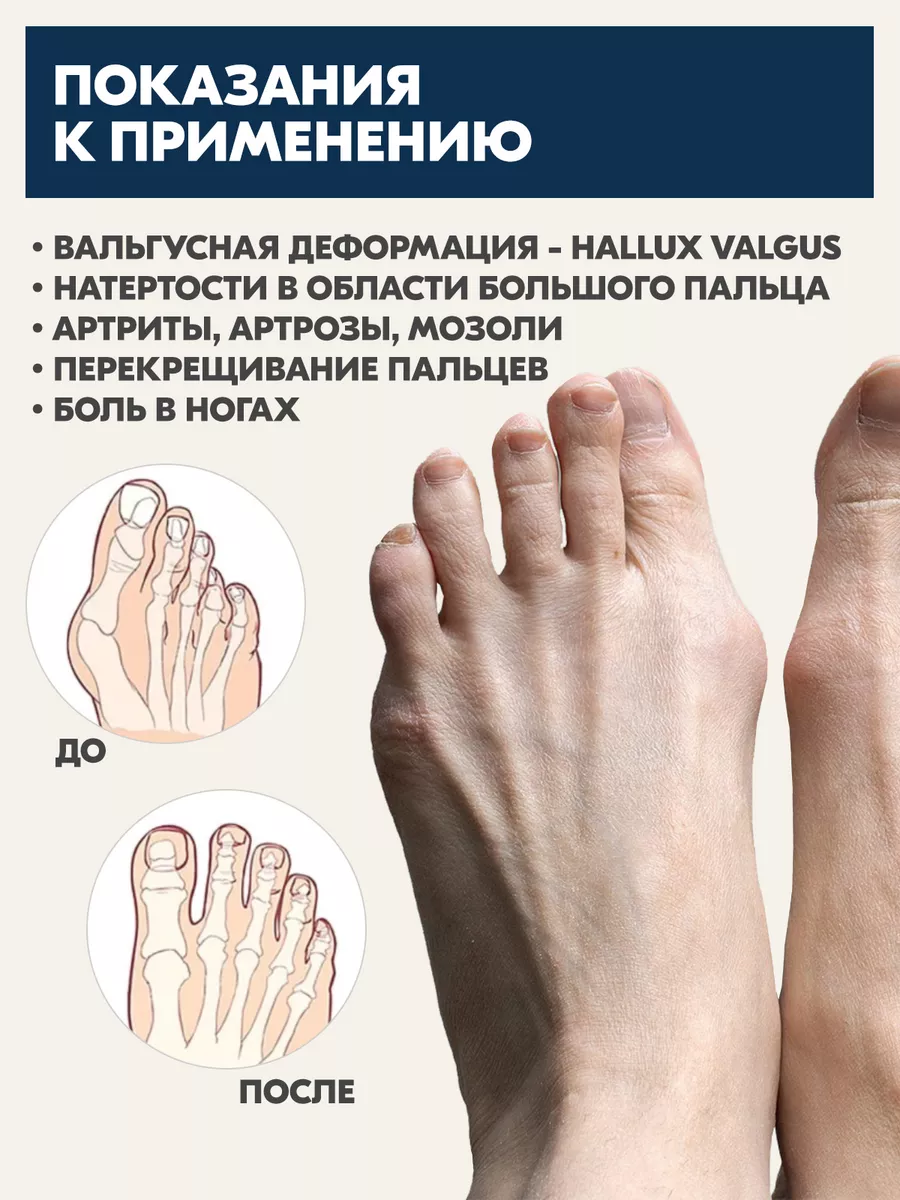 Ортопедический разделитель для большого пальца Skyfeet 182899340 купить за  175 ₽ в интернет-магазине Wildberries