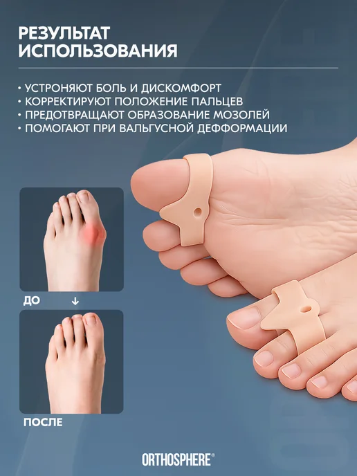 ORTHOSPHERE Ортопедический разделитель для большого пальца, вариант, фото 2