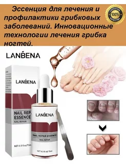 От грибка ногтей на ногах, средство противогрибковое LANBENA 184693586 купить за 215 ₽ в интернет-магазине Wildberries