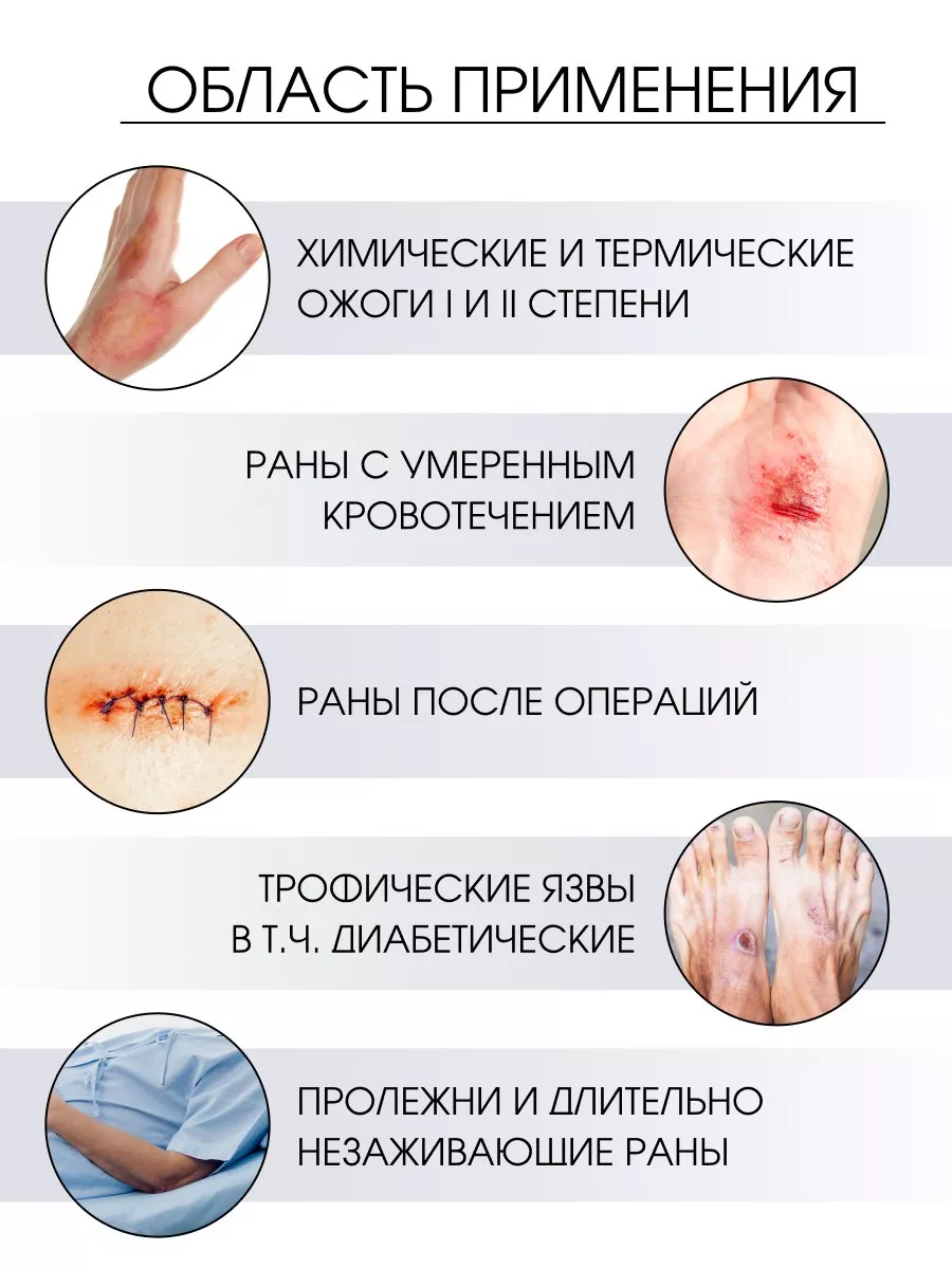 Альгинатная повязка от ран и пролежней 5 шт. OrtoX 185687271 купить за 667  ₽ в интернет-магазине Wildberries