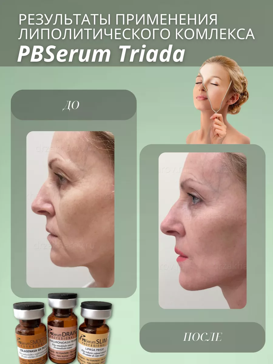 Сыворотка антицеллюлитная комплекс PBSerum Триада PBSerum Triada 188430106  купить за 3 311 ₽ в интернет-магазине Wildberries