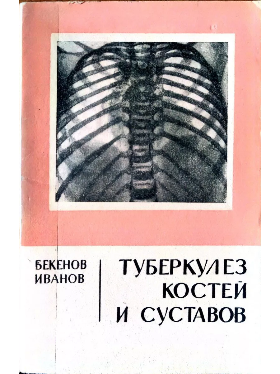 Туберкулез костей и суставов Казахстан 191027623 купить за 1 186 ₽ в  интернет-магазине Wildberries