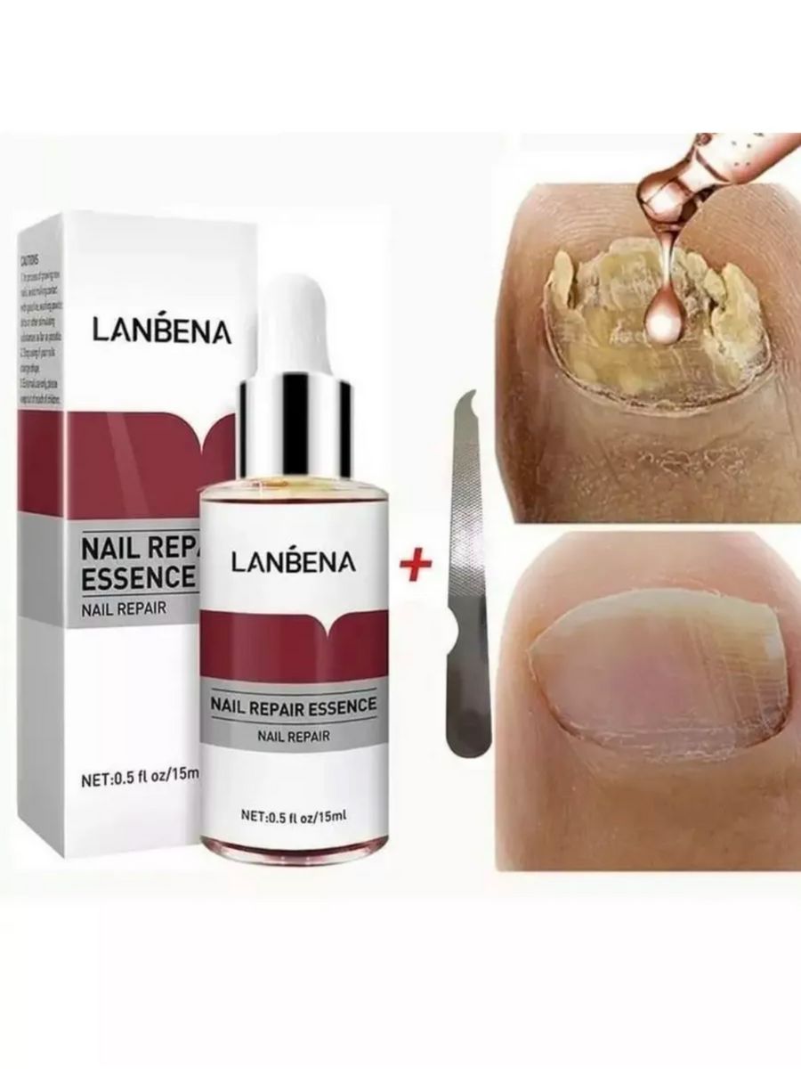 Средство от грибка ногтей LANBENA Nail Repair Essence 15 ml